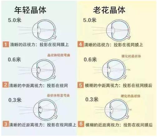 近視就不會老花了嗎？